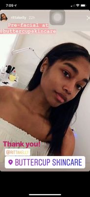 Buttercup Skin Care by null