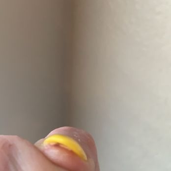 VIP Nails & Spa - Dried blood under the nail - Nail Salons Near Me - Lodi, California VIP Nails & Spa - Dried blood under the nail - Nail Salons Near Me - Lodi, California