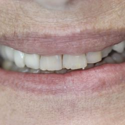 Parkhaven Dental Care - Before