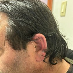 Brooklyn Audiology Associates - Sample of hearing device hardly noticeable at all