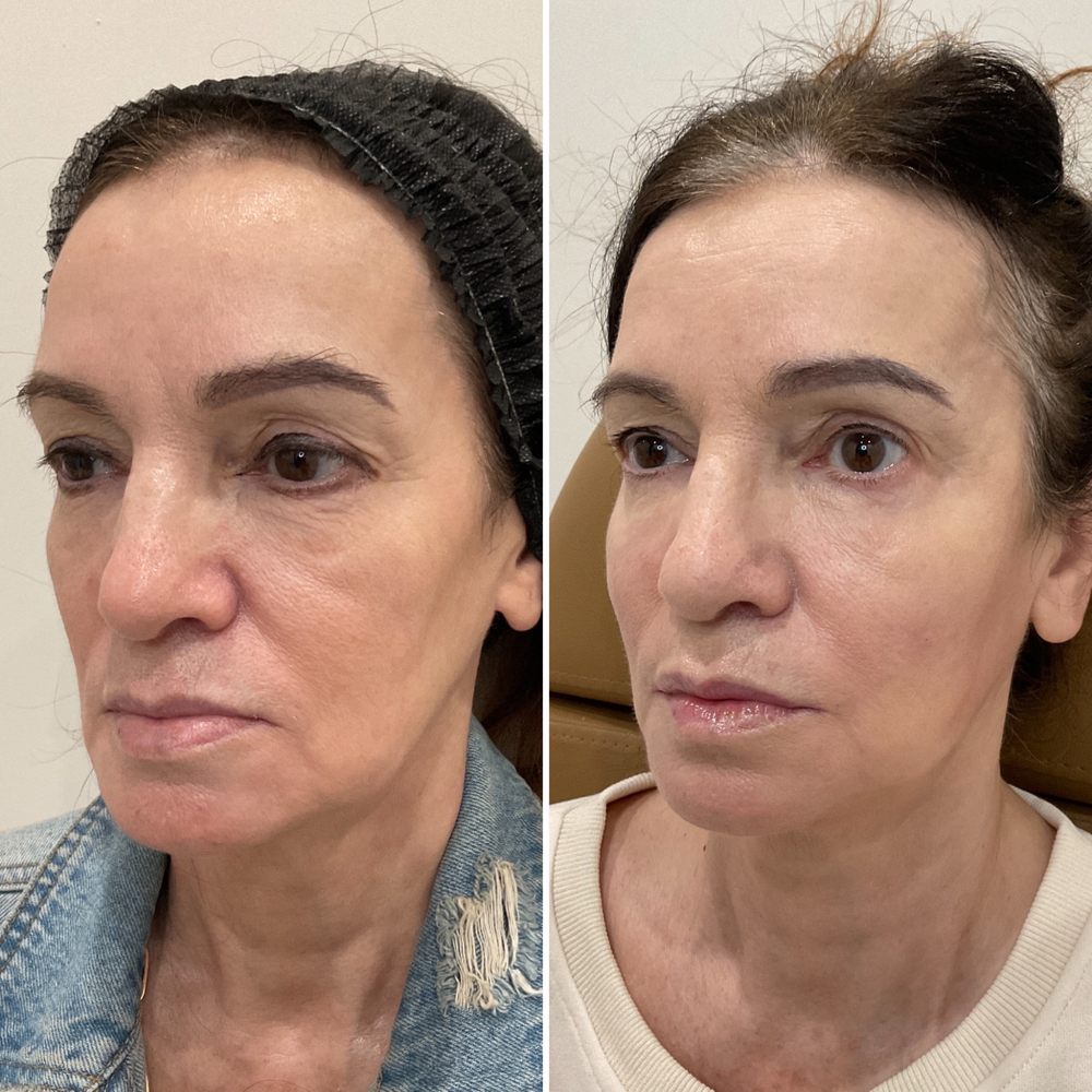 R+H Aesthetic Medicine, West Sac