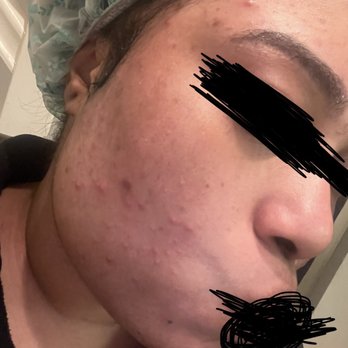 Beauty By Thread - Just look my my fucking face - Hair Removal Near Me - Sacramento, California Beauty By Thread - Just look my my fucking face - Hair Removal Near Me - Sacramento, California