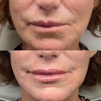 Skinsational Aesthetics - Medical Spas Near Me - Riverside, California