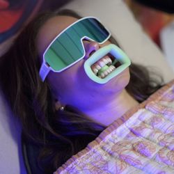 Sirius Glow Teeth Whitening