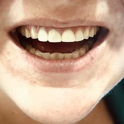 Bruner Dental