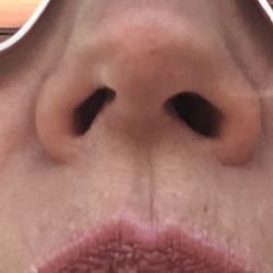 Biggerstaff & Associates - My nostrils are misaligned and I still can't breathe. It gets all clogged up now. Horrible job.