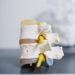 The Disc Chiropractic - Spinal disc model