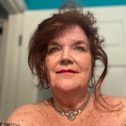Coastal Plastic Surgery Institute - Before laser and eyelift