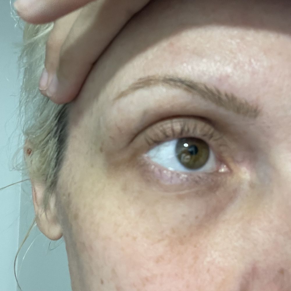the eye that did lift the eye that did lift