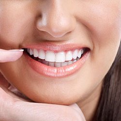White Smile Center
