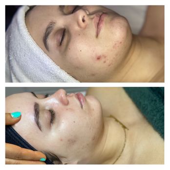 Tore Beauty - Estheticians Near Me - Union, New Jersey Tore Beauty - Estheticians Near Me - Union, New Jersey