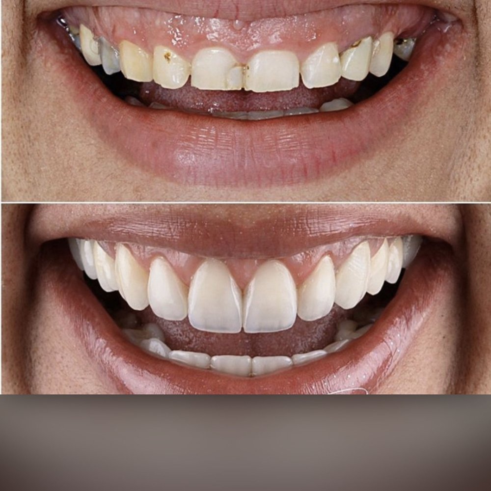 TOP 10 BEST Emergency Dentist in Orange, CA - Updated 2026 - Yelp