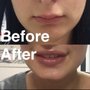 Photo of Rejuvenation Skin & Laser Center