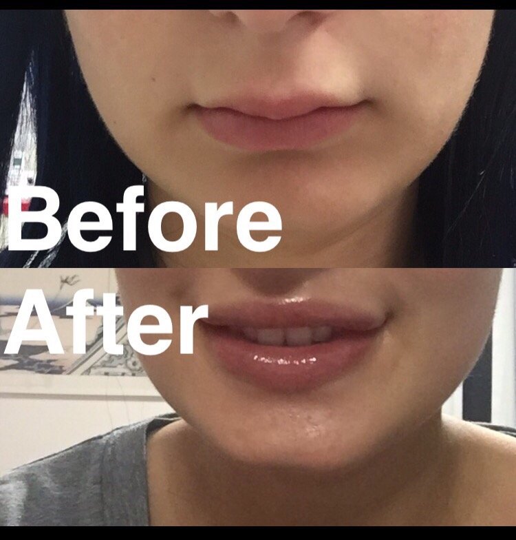 Rejuvenation Skin & Laser Center Logo
