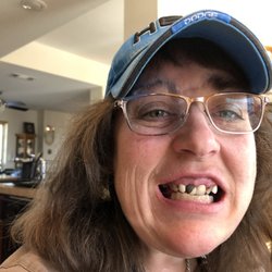 FastNewSmile - Failed crowns and rotten teeth.
