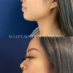 Sculpt Aesthetics Med Spa