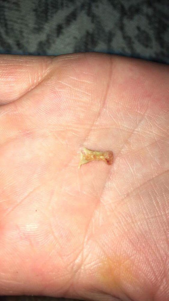 MARILLAC DENTAL CLINC Updated September 2024 2333 N 6th St, Grand