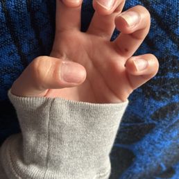 You can't really see but I got a small cut in my ring finger by the cuticle area underneath, and the nail beds were left weird. You can't really see but I got a small cut in my ring finger by the cuticle area underneath, and the nail beds were left weird.