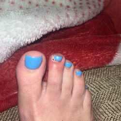 Jonathon Khoi Nail Spa - Infected, toe, pre-and post minor surgery with podiatrist