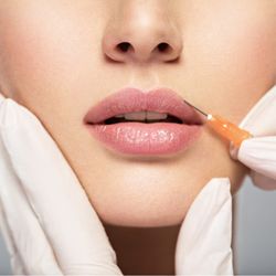 Synergy Skin & Laser Center - Juvederm and Restylane dermal fillers
