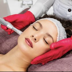 Vital Aesthetics - Microneedling