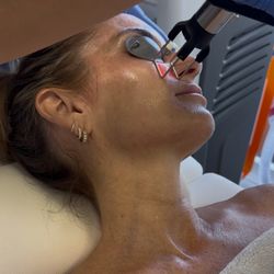 Gravity MedSpa - CoolPeel