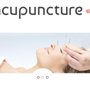 Photo of Acupuncture