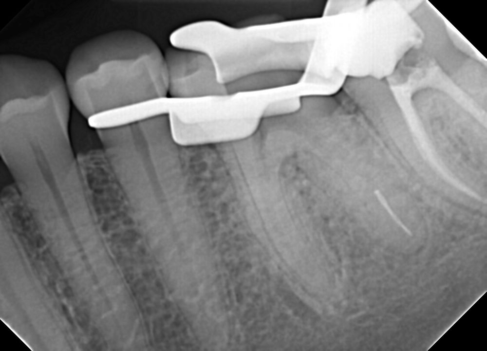 PLAINVIEW DENTAL Updated October 2024 1670 Old Country Rd