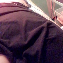 Comp Access - Acupuncture & Cupping