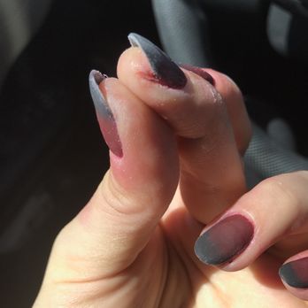 Lotus Nails - Cut here twice and have indents on other fingers from too much pressure. Didn't even try to clean it as it bled. - Nail Salons Near Me - Boulder, Colorado