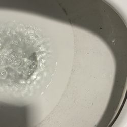 Kennedy Club Fitness - Mold growing in the toilet. When are these being cleaned?!