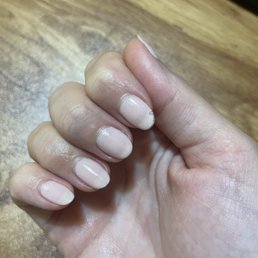 You can see how chipped they are and the bubbles