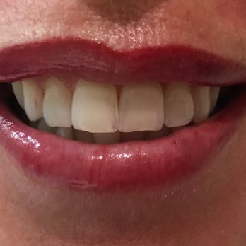 L'Atelier Permanent Makeup - Full lips Micropigmentation - Permanent Makeup Near Me - Osterville, Massachusetts L'Atelier Permanent Makeup - Full lips Micropigmentation - Permanent Makeup Near Me - Osterville, Massachusetts