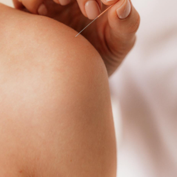 Tigerlily Holistic - Acupuncture Near Me - Brooklyn, New York