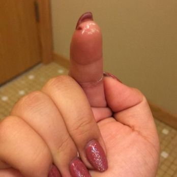 Tracy Nails - I couldn't get it to focus and excuse the white paint on my finger but that's the cut I got from the nail file - Nail Salons Near Me - Brooklyn Center, Minnesota