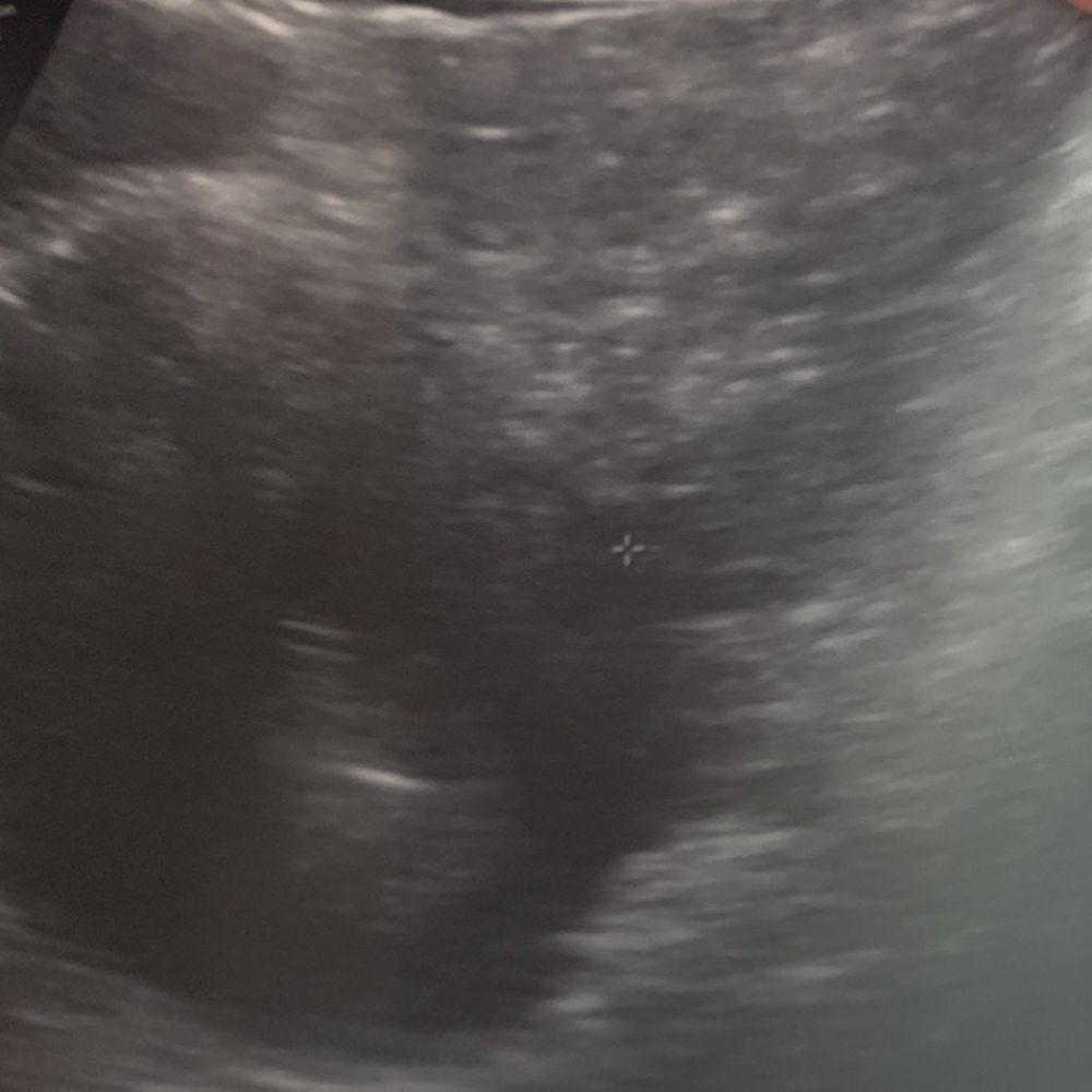 Center For Reproductive Endocrinology - Fertility Near Me - Dallas, Texas