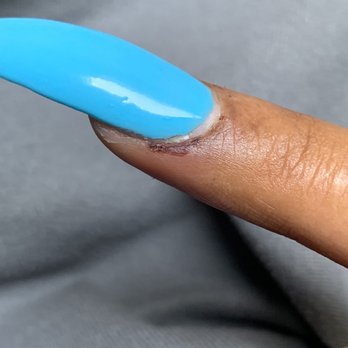 Savy Nail - Glue and acrylic liquid or primer burned my finger and cuts from her continuing to file after - Nail Salons Near Me - Upland, California Savy Nail - Glue and acrylic liquid or primer burned my finger and cuts from her continuing to file after - Nail Salons Near Me - Upland, California