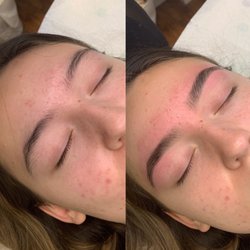 Before & after