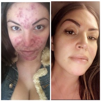 Style Queens Beauty - Skin Care Near Me - Fontana, California Style Queens Beauty - Skin Care Near Me - Fontana, California