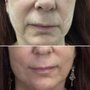 Photo of Dermabeauty Medical Spa