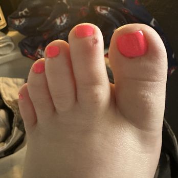 Eternity Nail Bar - Sliced apart of my toe when attempting to cut the cuticle! - Nail Salons Near Me - Melissa, Texas