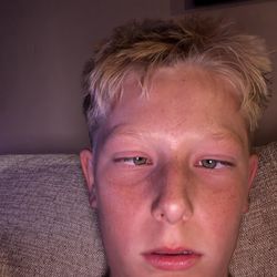 Arden Middle School - His mental disability