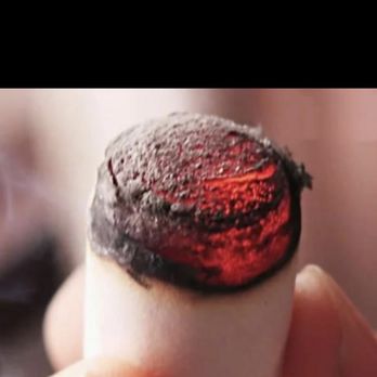 WL Wellness - Moxibustion - Acupuncture Near Me - San Jose, California WL Wellness - Moxibustion - Acupuncture Near Me - San Jose, California