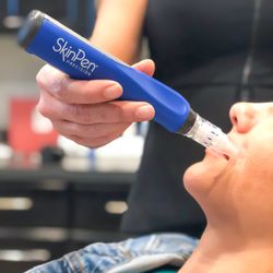 Bella Luce Med Spa - MicroNeedling with Skin Pen
