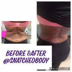 Snatched Body Health Spa - Woodtherpy for an aftercare client we were able to shape and sculpt her in 1 treatment!! Feel free to visit our site www.snatchedbody.net