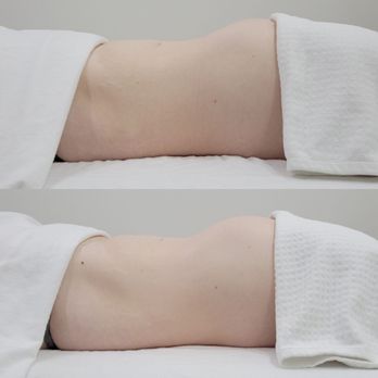Bodyby_emilyg - Brazilian Lymphatic detox - Body Contouring Near Me - Torrance, California Bodyby_emilyg - Brazilian Lymphatic detox - Body Contouring Near Me - Torrance, California