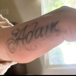 Before tattoo removal