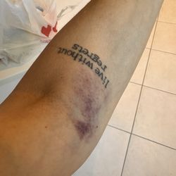 Quest Diagnostics - Bruises
