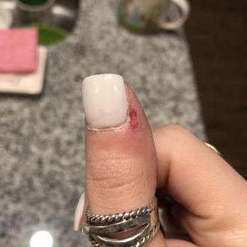 Posh Nails & Spa - You can see where I was bleeding and where there is red on the nail because he just painted right over the blood. - Nail Salons Near Me - Tulsa, Oklahoma Posh Nails & Spa - You can see where I was bleeding and where there is red on the nail because he just painted right over the blood. - Nail Salons Near Me - Tulsa, Oklahoma