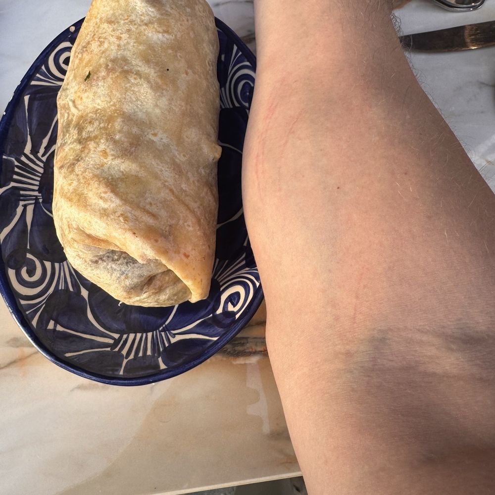 Los Tacos - That's my arm for comparison - Tacos Near Me - Carlsbad, California Los Tacos - That's my arm for comparison - Tacos Near Me - Carlsbad, California